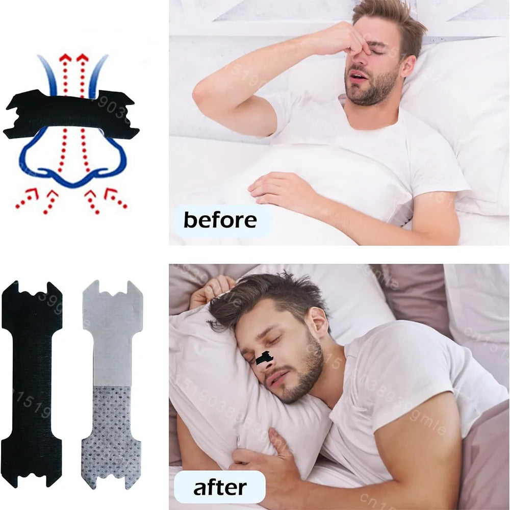 Anti Snoring Mouth Tape & Nose Breathing Sticker Night Sleeping Mouth Breath Improvement Patch Reduce Dry Mouth Promote